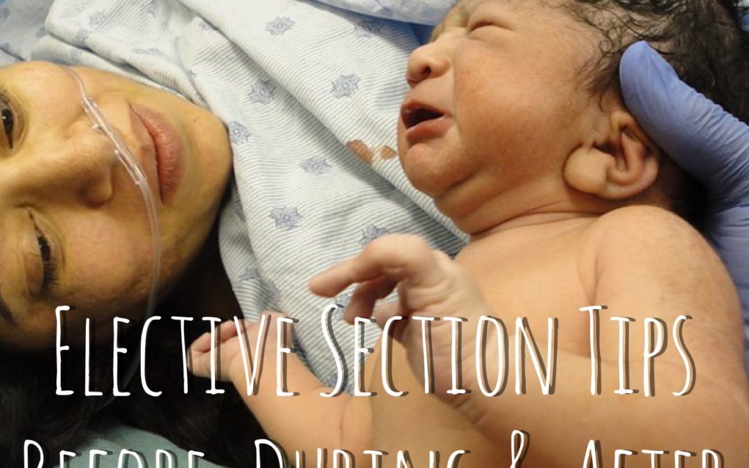 Caesarean / C-Section Tips – Before, During & After