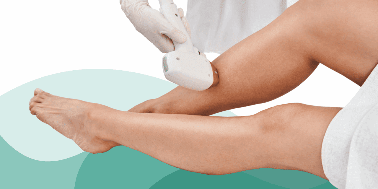 How Often Should I Get Laser Hair Removal?