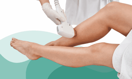 How Often Should I Get Laser Hair Removal?
